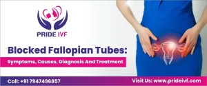 Read more about the article Blocked Fallopian Tubes: Symptoms, Causes, Diagnosis and Treatment